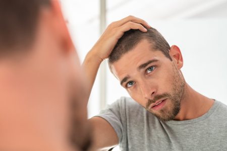 hair-loss-men